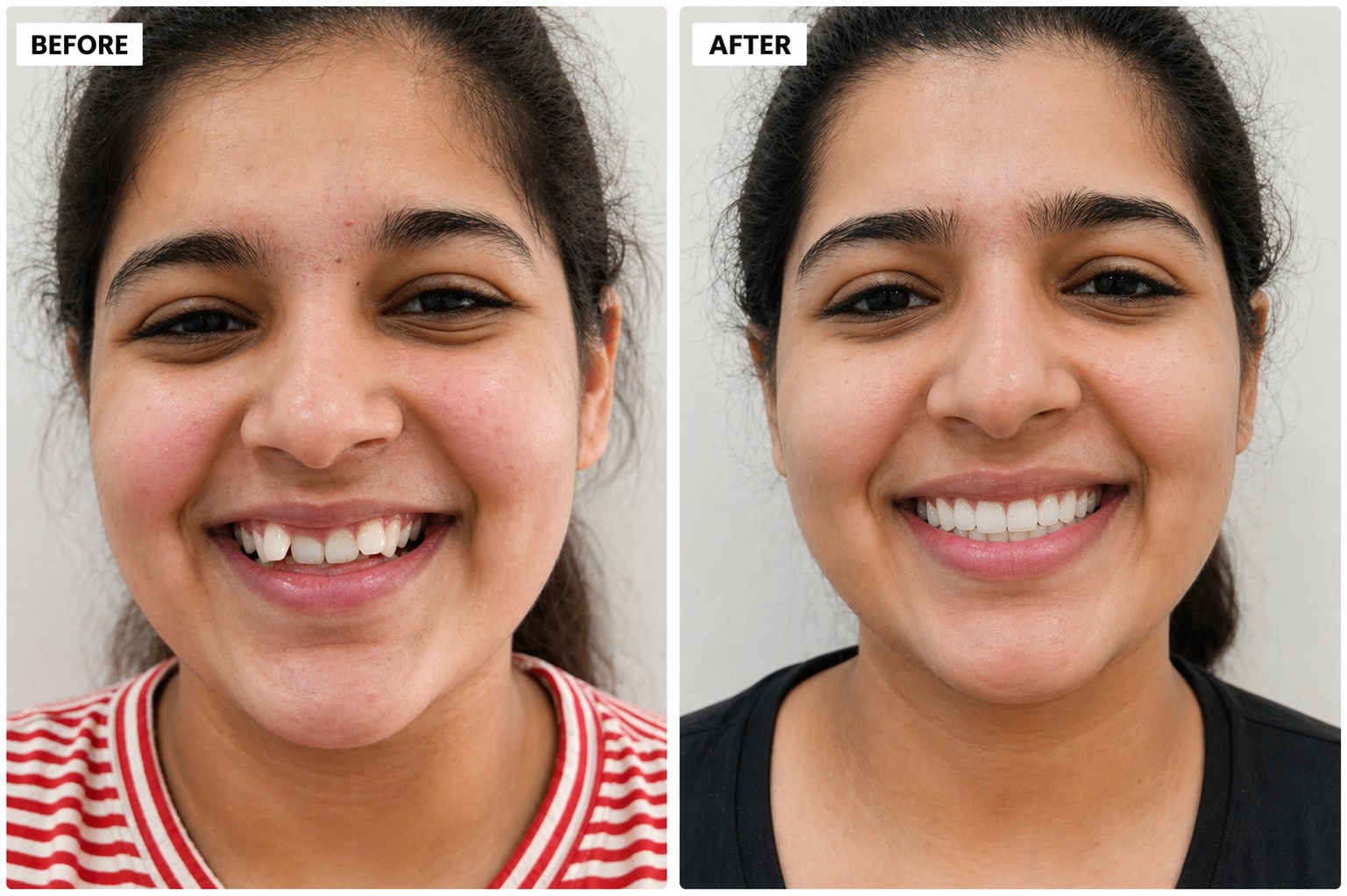 Smile Transformation 7